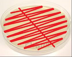 Kliininen tutkimusprosessi mikrobiologian laboratoriossa – Virtsan  bakteerien polku mikrobiologian laboratoriossa